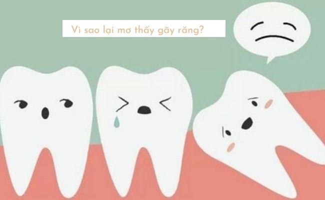 Mơ thấy gãy răng điềm gì? Giải mã bí ẩn 8 giấc mơ về răng