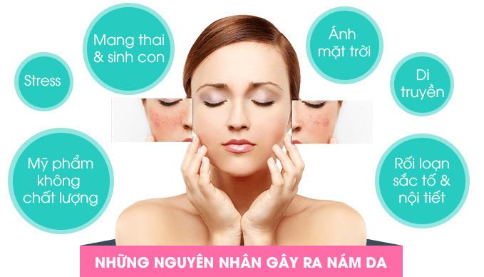 Nguyên nhân gây nám da? Tại sao nám da thường xảy ra ở phụ nữ?