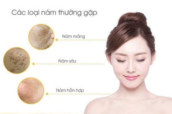 Nguyên nhân gây nám da? Tại sao nám da thường xảy ra ở phụ nữ?