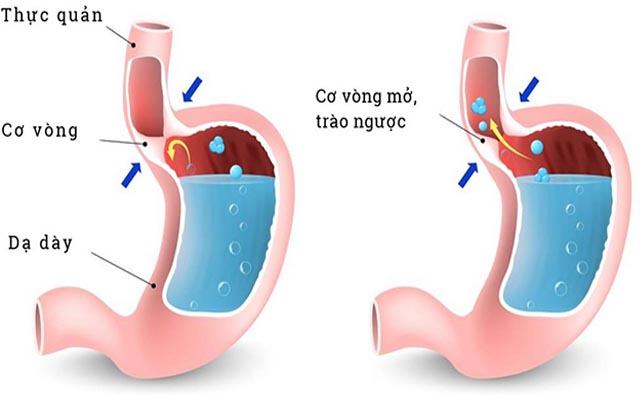 uống gừng mật ong khi nào